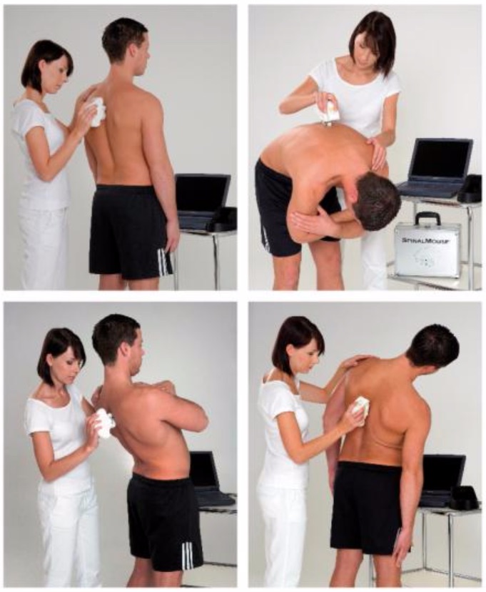 spinalmouse-valutazione-della-colonna-vertebrale-degli-aspetti-posturali-applicazione