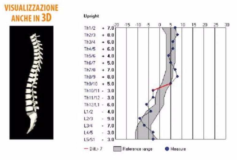 spinalmouse-valutazione-della-colonna-vertebrale-degli-aspetti-posturali-grafico